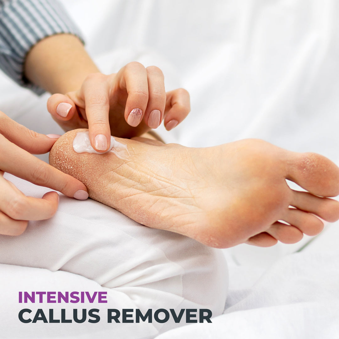 Intensive Callus Remover